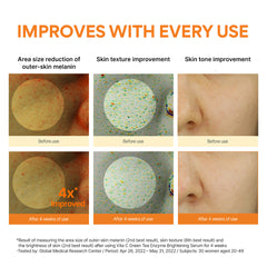 Vitamin C Green Tea Enzyme Brightening Serum 30ml Vitamin C Green Tea Enzyme Brightening Serum 30ml