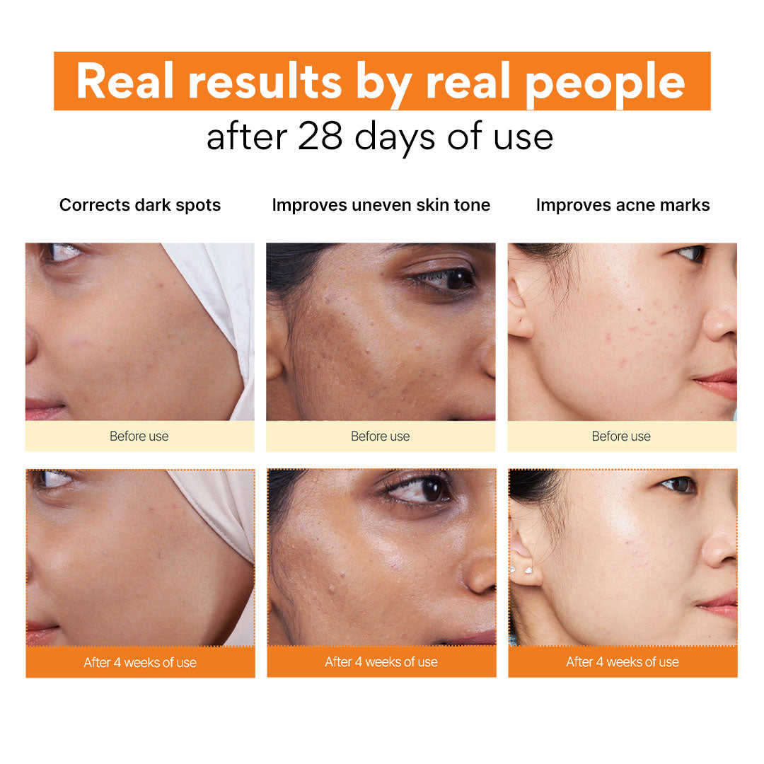 Vitamin C Green Tea Enzyme Brightening Serum 30ml – innisfree