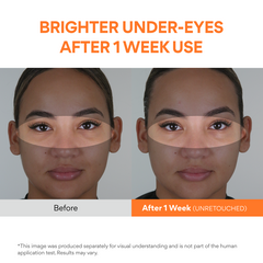 [COMING SOON] Vitamin C Niacinamide Eye Serum 10ml